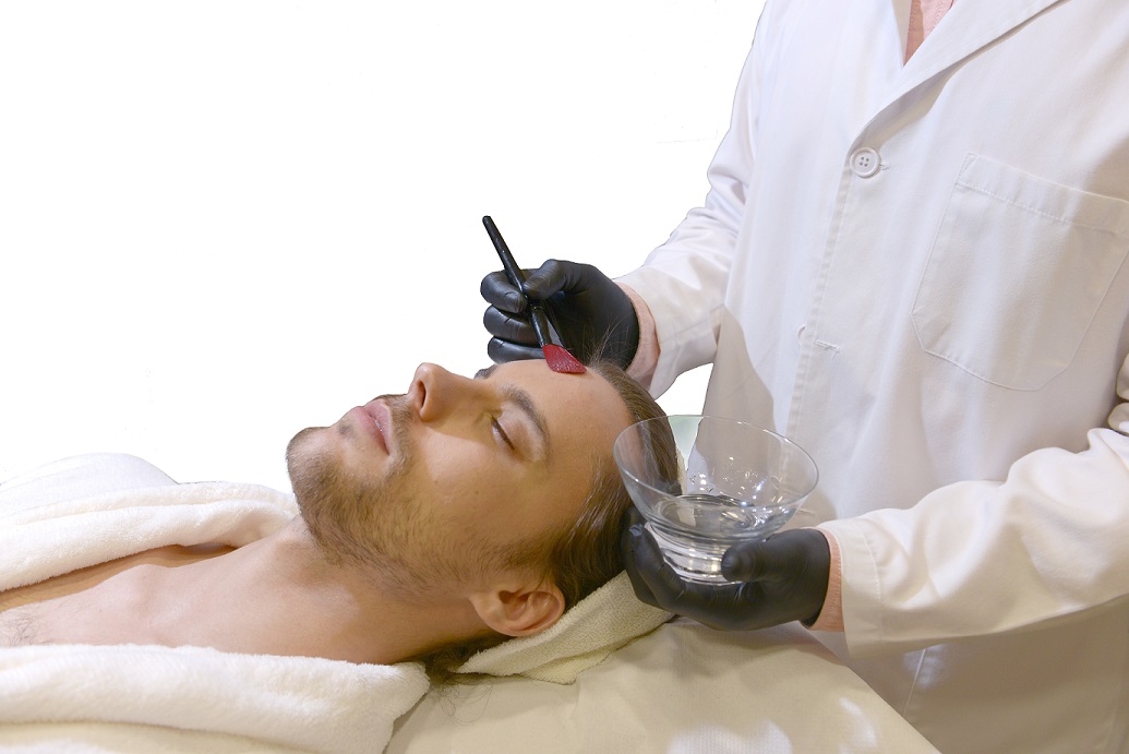 chemical-peels-for-men