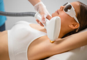 underarm laser hair removal procedur